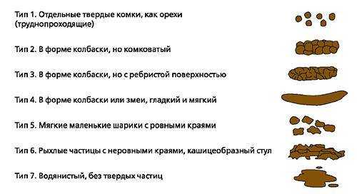 К чему снятся экскременты человека: толкование сна, его значение и выбор сонника