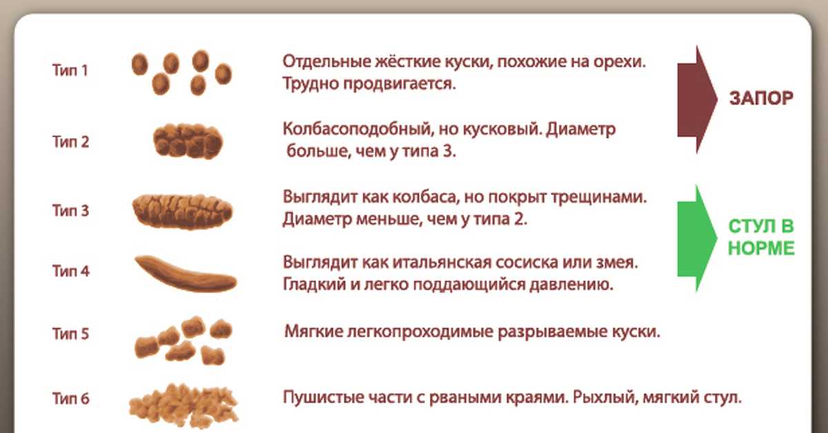 К чему сниться запах кала