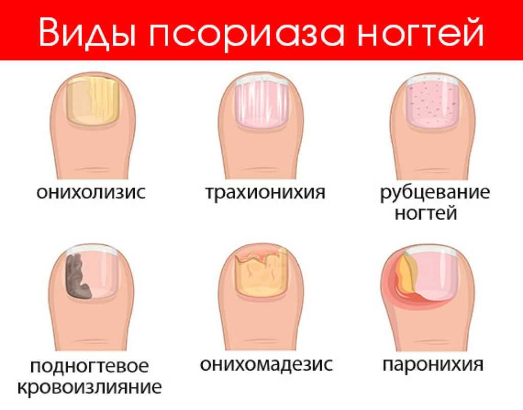 К чему снятся длинные или неухоженные ногти на руках