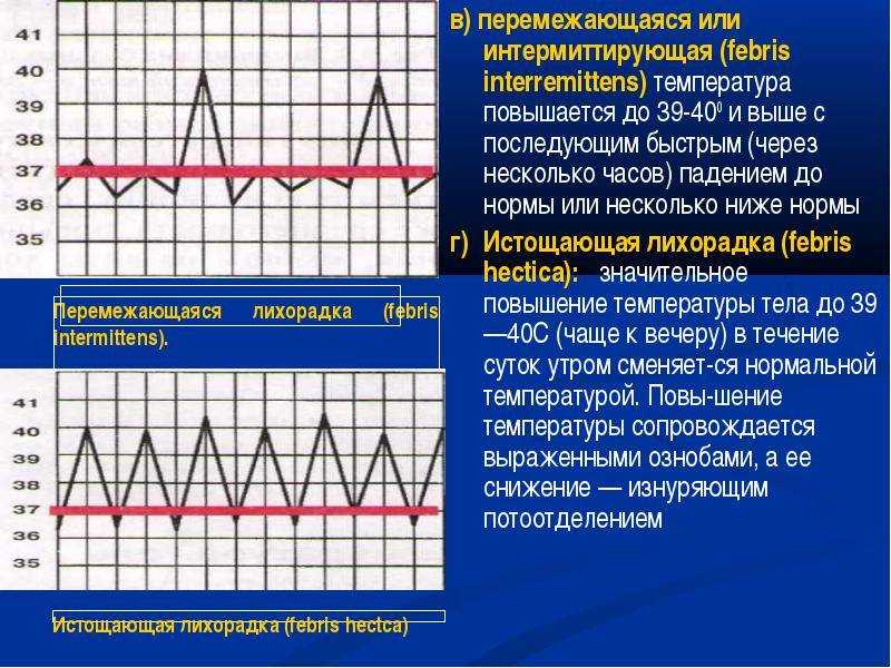 Какая температура является нормальной во время сна