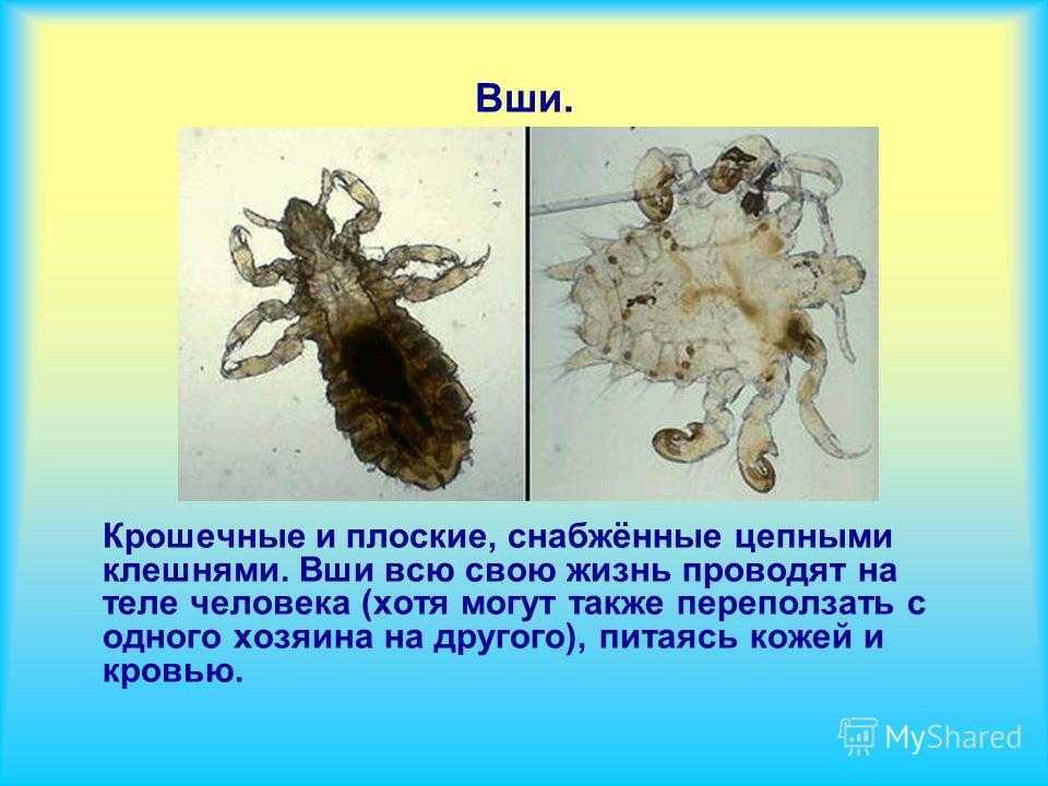 К чему снятся  вши во сне — по 90 сонникам! если видишь во сне вши что значит?