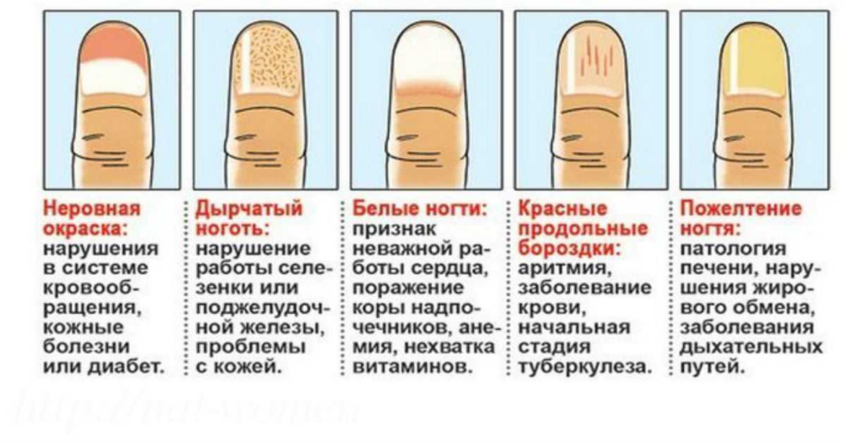 К чему снятся ногти, сонник – ногти во сне