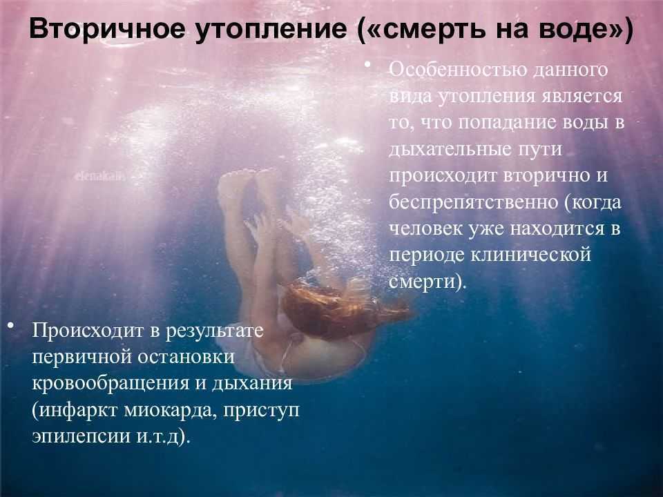 Сонник: к чему во сне снится тонуть в болоте или море и спастись из воды?