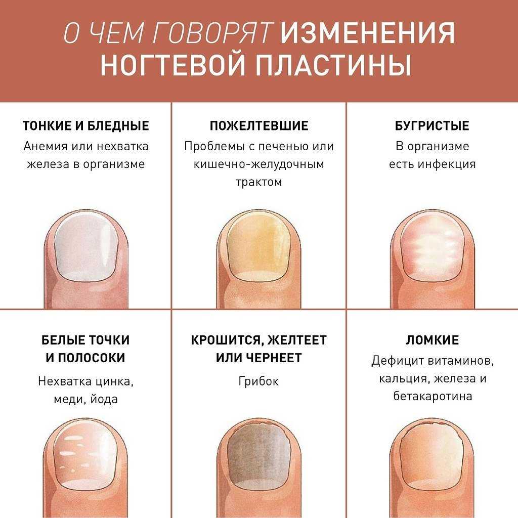 К чему снятся  ногти во сне — по 90 сонникам! если видишь во сне ногти что значит?