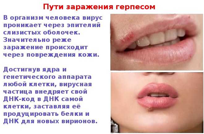 К чему снится простуда на губе сонник