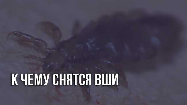 К чему снятся вши? сонник-толкование