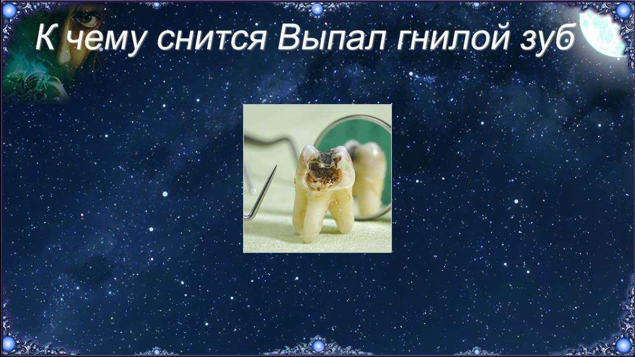 К чему снится выпавший гнилой зуб? значение сна, самое полное толкование - tolksnov.ru