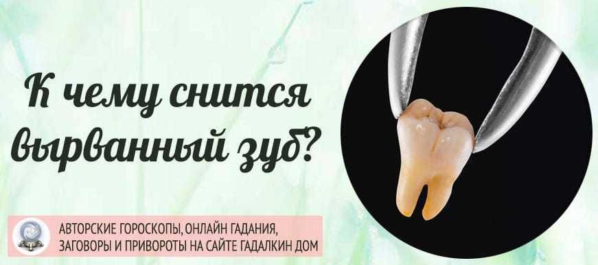 К чему снится, что крошатся зубы: у тебя или у кого-то из близких. основные толкования, к чему снится, что крошатся зубы