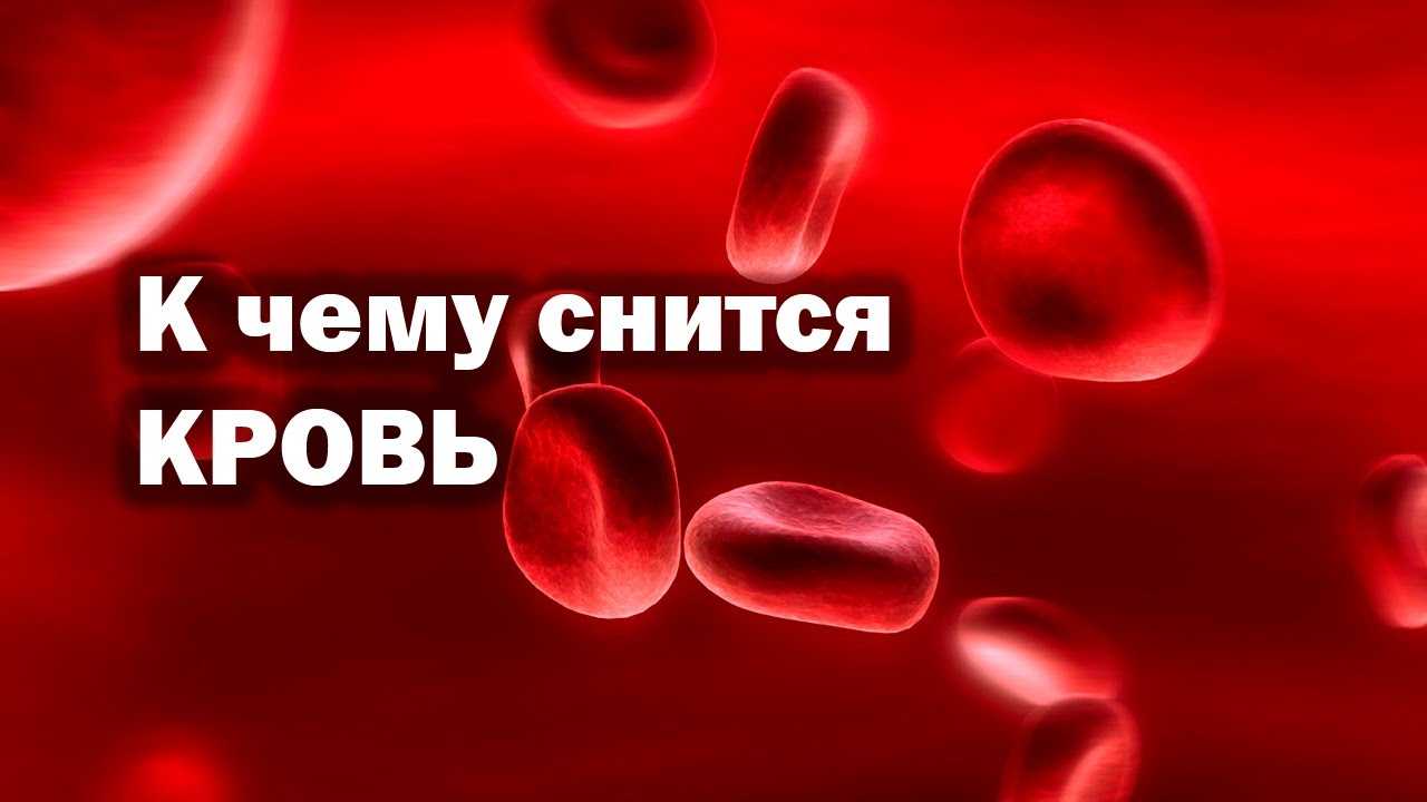 ᐉ к чему снится кровь из глаз сонник - x-sonnik.ru